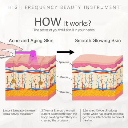 Portable High Frequency Skin