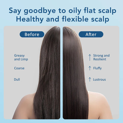 Electric Massage Comb Scalp